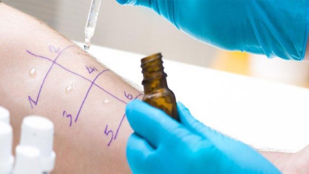 allergologia Allergologo Roma